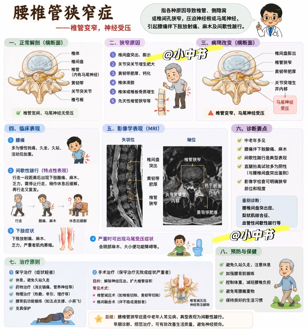 腰椎管狭窄症临床速记📚