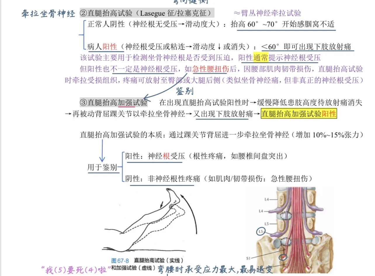 直腿抬高试验(Lasegue征)临床速记📚✨