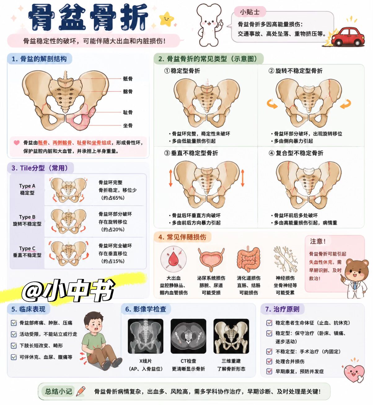 🩺骨盆骨折｜一篇搞懂