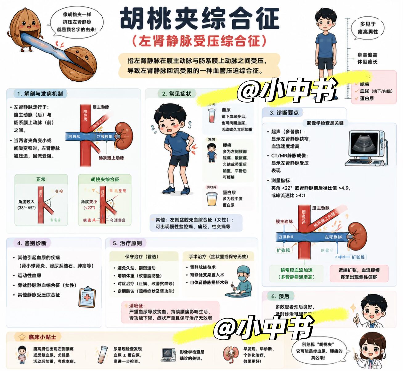 🫘胡桃夹综合征（左肾静脉受压综合征）｜临床速记一图看懂