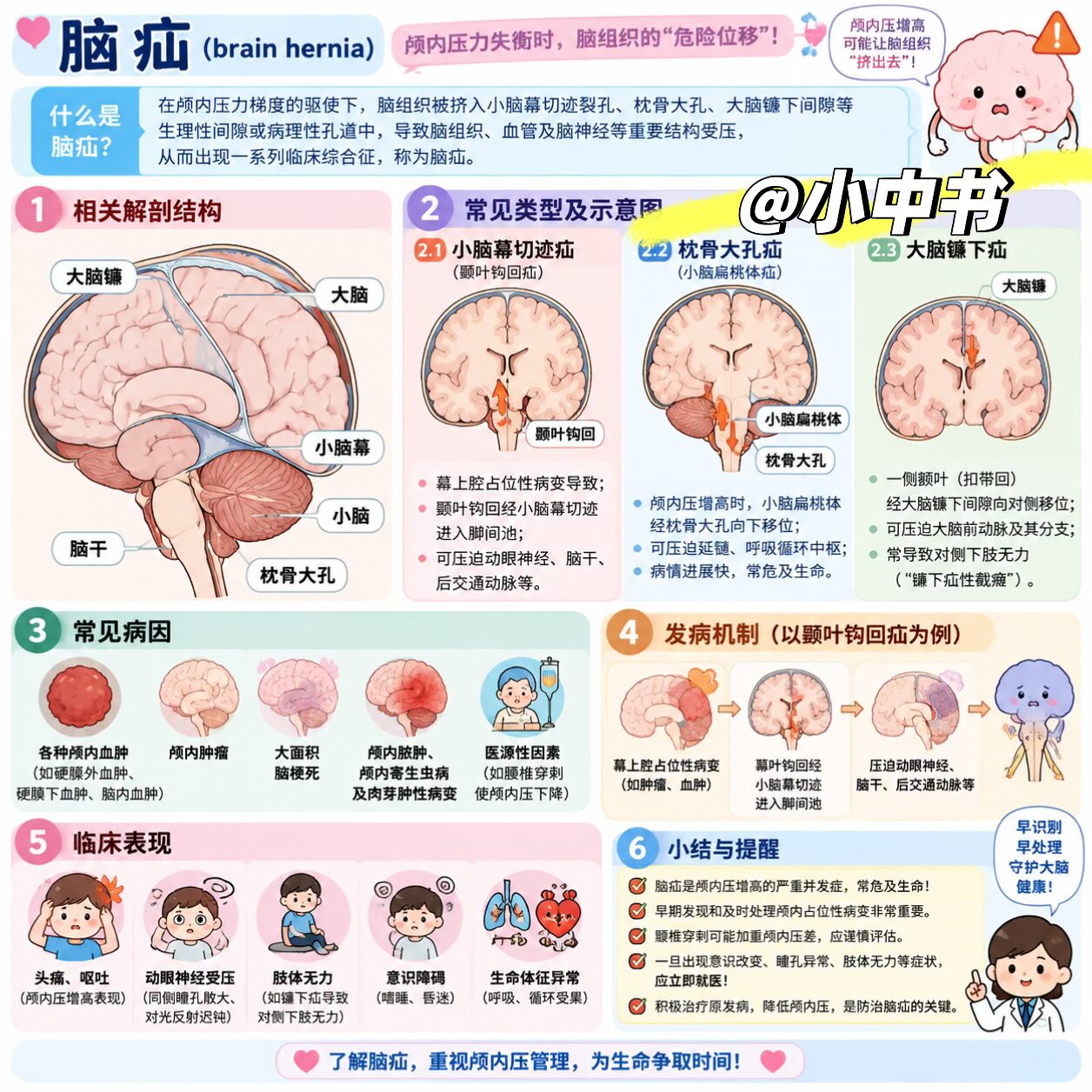 🧠⚠️ 脑疝是什么？一张图带你了解“颅内压力危机”